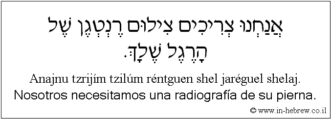 Español y hebreo: Nosotros necesitamos una radiografía de su pierna.
